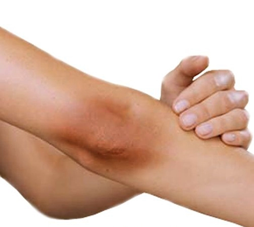 Tổng hợp mẹo đơn giản giúp khuỷu tay mịn trắng đều