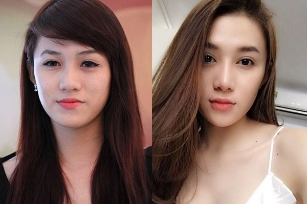Danh sách thí sinh the face vietnam bị nghi đã qua dao kéo
