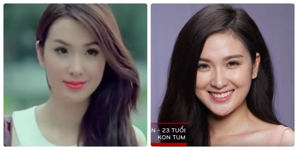 Danh sách thí sinh the face vietnam bị nghi đã qua dao kéo