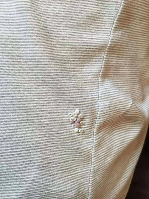 Thấy những hạt nhỏ này khi rút quần áo thì hãy cẩn thận