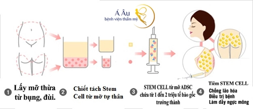 Trẻ hóa da nhờ mô mỡ nguyên bào tự thân