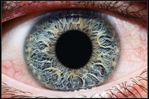 Bạn biết gì về ý nghĩa của chấm đen trên mống mắt 