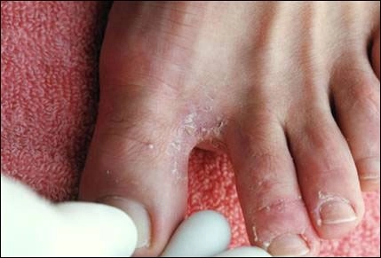 Những lý do bạn nên đứng tiểu khi đi tắm