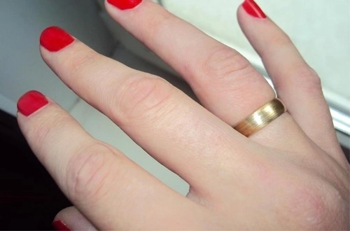 Cách đeo trang sức để không bị ngứa rát nhiễm trùng mưng mủ