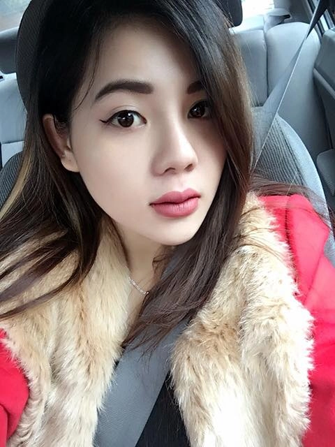 nữ việt kiều mỹ chọn thẩm mỹ mũi tại việt nam