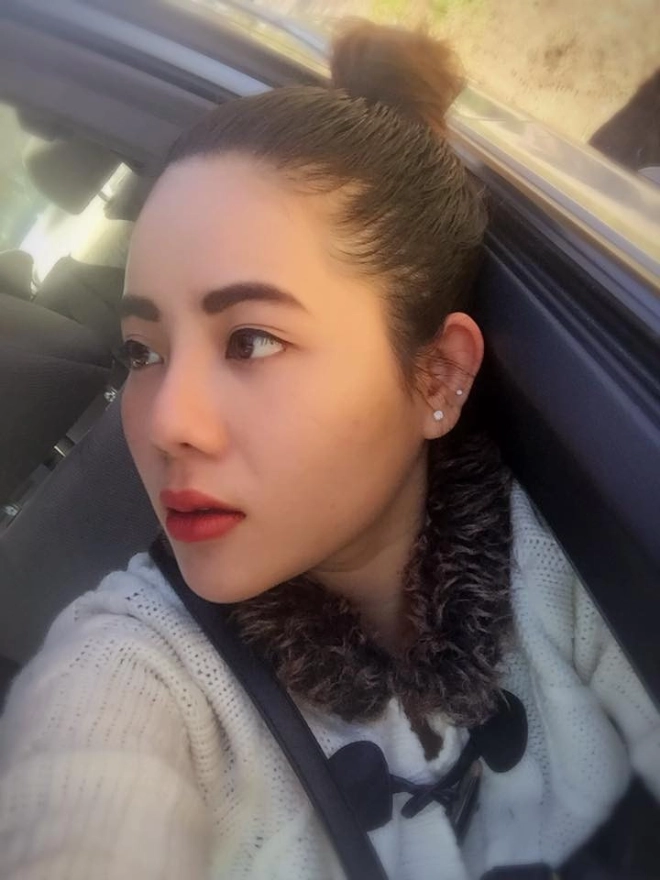 nữ việt kiều mỹ chọn thẩm mỹ mũi tại việt nam