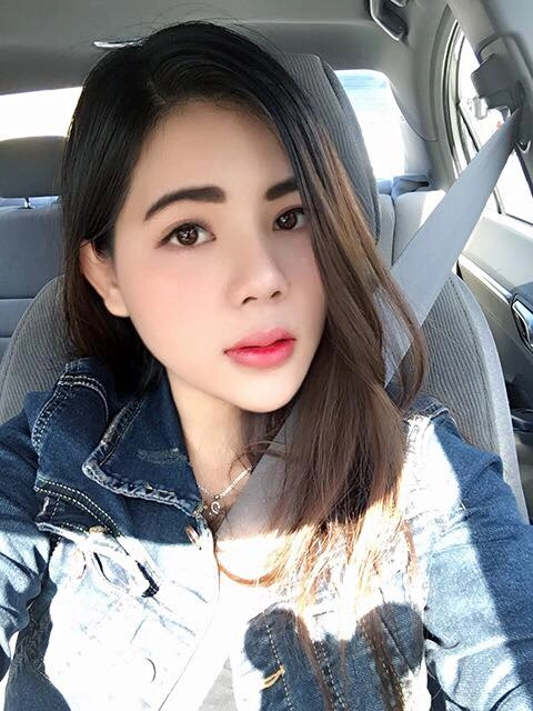 nữ việt kiều mỹ chọn thẩm mỹ mũi tại việt nam