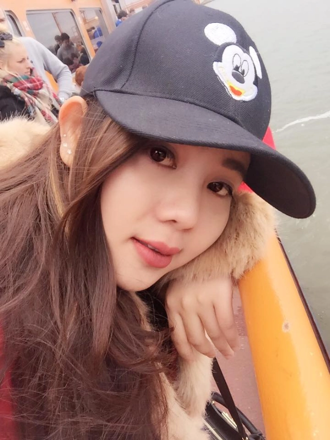 nữ việt kiều mỹ chọn thẩm mỹ mũi tại việt nam