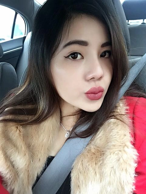 nữ việt kiều mỹ chọn thẩm mỹ mũi tại việt nam