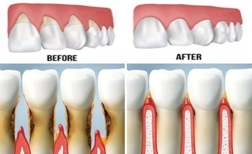 Bệnh về răng miệng nguy hiểm mà bạn cần phải biết
