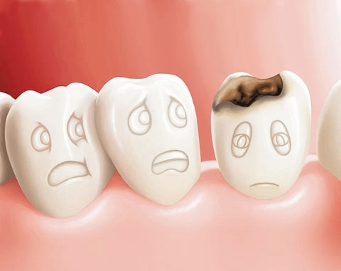 Bị thủng ruột vì thói quen ngậm tăm xỉa răng