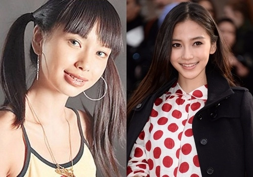 Đôi khi niềng răng không phải cứ đau là sẽ đẹp