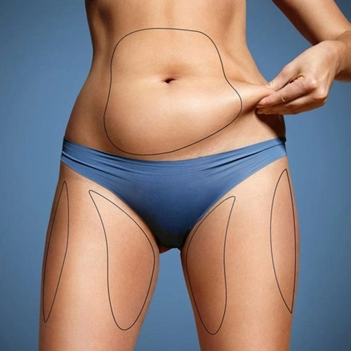 Đắp đá 30 phút mỗi ngày mỡ bụng mỡ đùi diệt hết ngay có nên tin