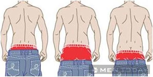 Phong cách thời trang quần tụt xấu xí