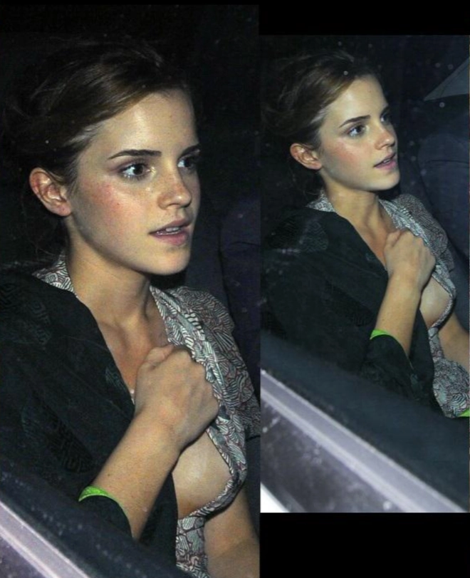 Emma watson gặp sự cố trang phục 